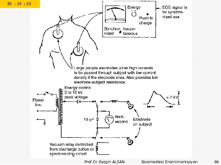 Prof. Dr. Sezgin ALSAN Biyomedikal Enstrümantasyon 66 