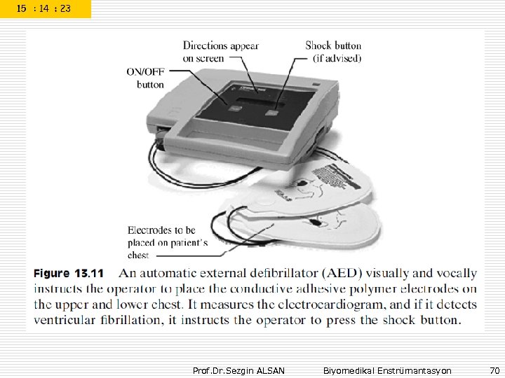 Prof. Dr. Sezgin ALSAN Biyomedikal Enstrümantasyon 70 