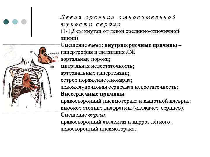 Определение сердечной тупости. Причины смещения левой границы относительной тупости сердца. Смещение левой границы относительной тупости сердца влево. Митральная недостаточность границы относительной тупости. Границы относительной сердечной тупости при ХСН.