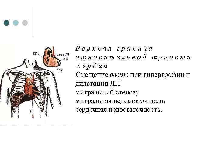 Верхняя граница относительной сердечной