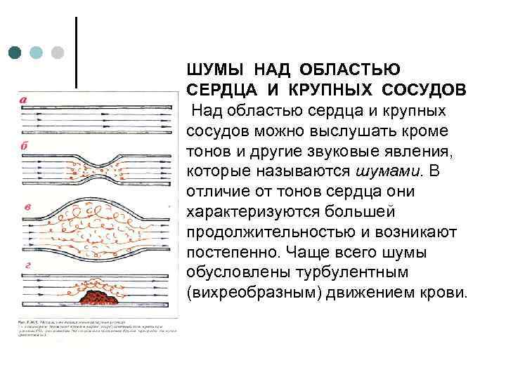 ШУМЫ НАД ОБЛАСТЬЮ СЕРДЦА И КРУПНЫХ СОСУДОВ Над областью сердца и крупных сосудов можно