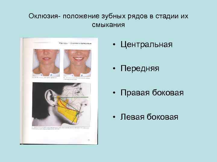 Оклюзия- положение зубных рядов в стадии их смыкания • Центральная • Передняя • Правая