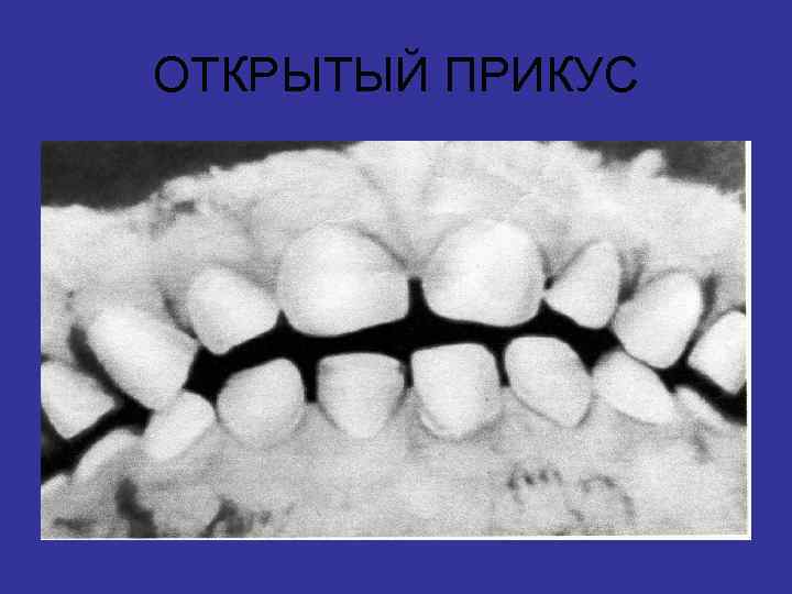 ОТКРЫТЫЙ ПРИКУС 