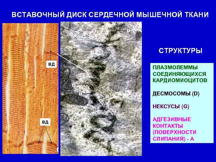 ВСТАВОЧНЫЙ ДИСК СЕРДЕЧНОЙ МЫШЕЧНОЙ ТКАНИ СТРУКТУРЫ ВД ПЛАЗМОЛЕММЫ СОЕДИНЯЮЩИХСЯ КАРДИОМИОЦИТОВ ДЕСМОСОМЫ (D) НЕКСУСЫ (G)