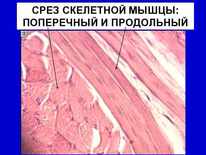 СРЕЗ СКЕЛЕТНОЙ МЫШЦЫ: ПОПЕРЕЧНЫЙ И ПРОДОЛЬНЫЙ 