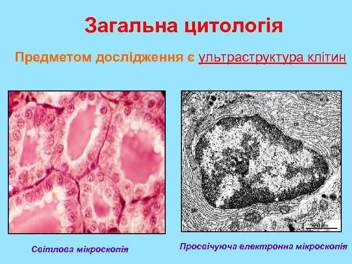 Загальна цитологія Предметом дослідження є ультраструктура клітин Світлова мікроскопія Просвічуюча електронна мікроскопія 