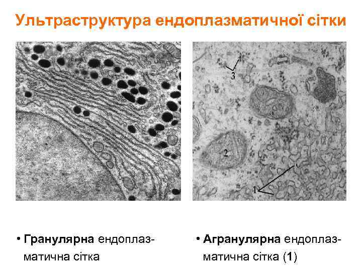 Ультраструктура ендоплазматичної сітки • Гранулярна ендоплазматична сітка • Агранулярна ендоплазматична сітка (1) 