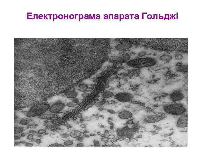 Електронограма апарата Гольджі 