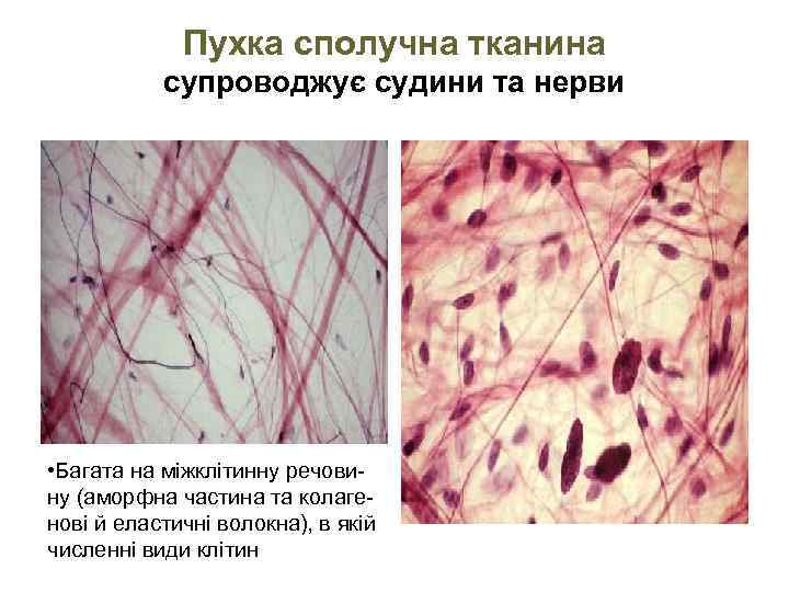 Пухка сполучна тканина супроводжує судини та нерви • Багата на міжклітинну речовину (аморфна частина