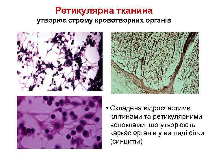 Ретикулярна тканина утворює строму кровотворних органів • Складена відросчастими клітинами та ретикулярними волокнами, що