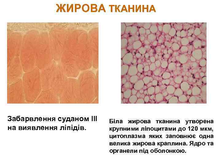 ЖИРОВА ТКАНИНА Забарвлення суданом III на виявлення ліпідів. Біла жирова тканина утворена крупними ліпоцитами