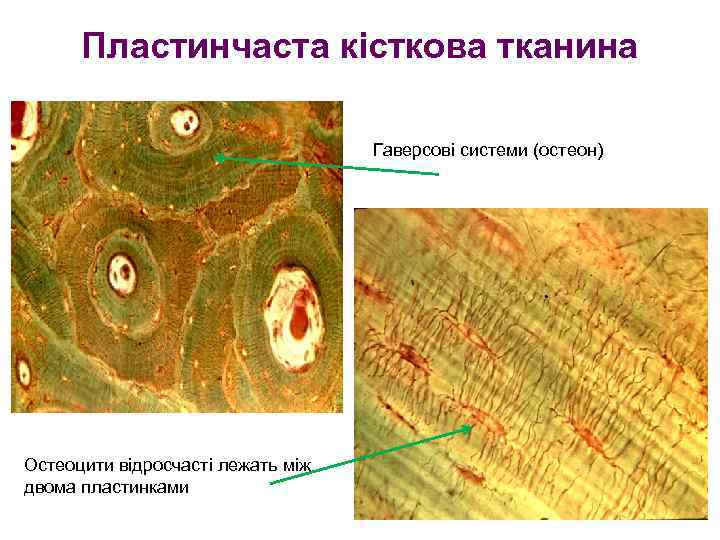 Пластинчаста кісткова тканина Гаверсові системи (остеон) Остеоцити відросчасті лежать між двома пластинками 
