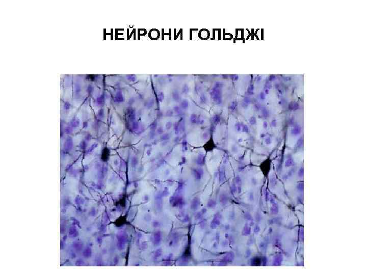 НЕЙРОНИ ГОЛЬДЖІ 