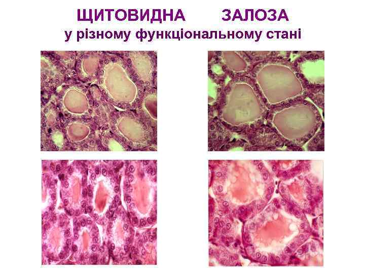 ЩИТОВИДНА ЗАЛОЗА у різному функціональному стані 