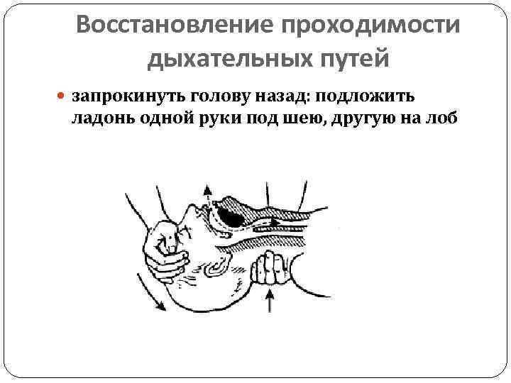 Последовательность восстановления проходимости дыхательных путей. Методы восстановления проходимости дыхательных путей. Протокол восстановления проходимости дыхательных путей. Трубку для восстановления проходимости дыхательных путей. Трубка для проходимости дыхательных путей.