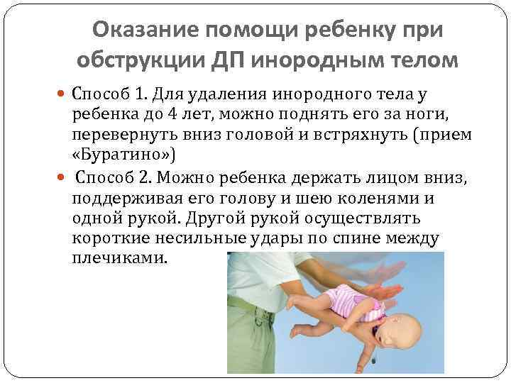 Оказание помощи ребенку при обструкции ДП инородным телом Способ 1. Для удаления инородного тела