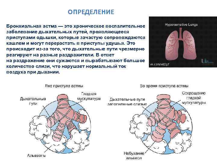 Для бронхиальной астмы характерно тест