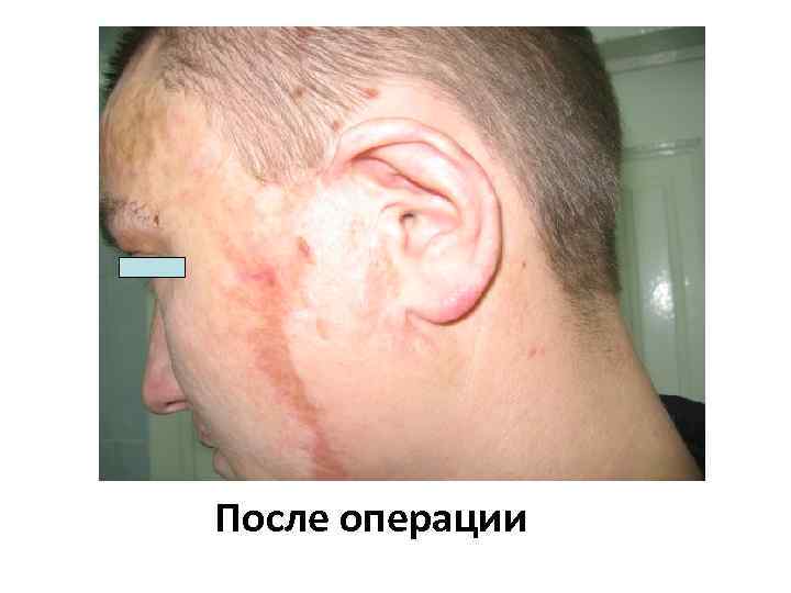 После операции 