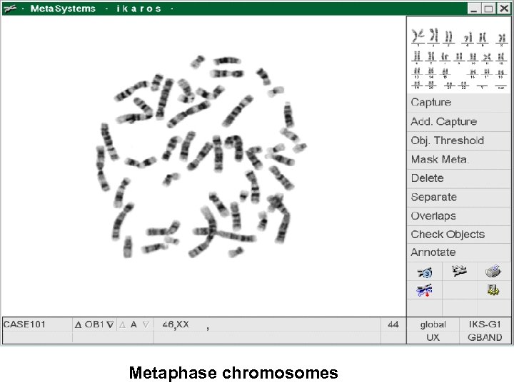 Metaphase chromosomes 