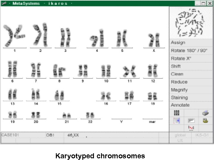 Karyotyped chromosomes 