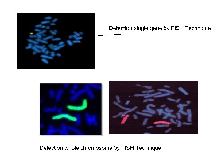  Detection single gene by FISH Technique Detection whole chromosome by FISH Technique 