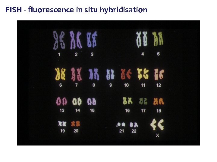 FISH - fluorescence in situ hybridisation 