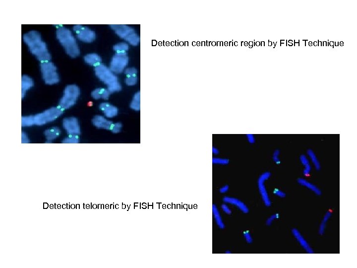 Detection centromeric region by FISH Technique Detection telomeric by FISH Technique 