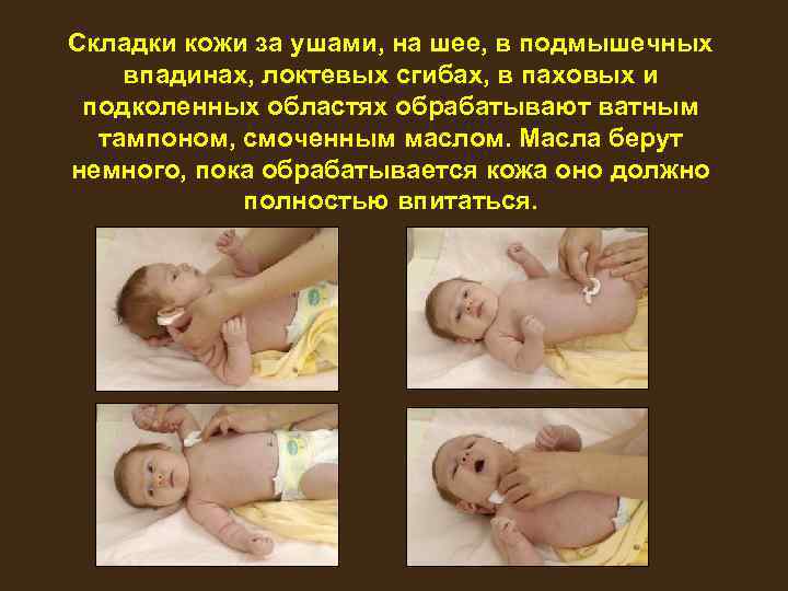 Складки кожи за ушами, на шее, в подмышечных впадинах, локтевых сгибах, в паховых и