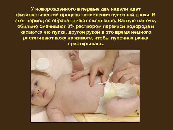 У новорожденного в первые две недели идет физиологический процесс заживления пупочной ранки. В этот