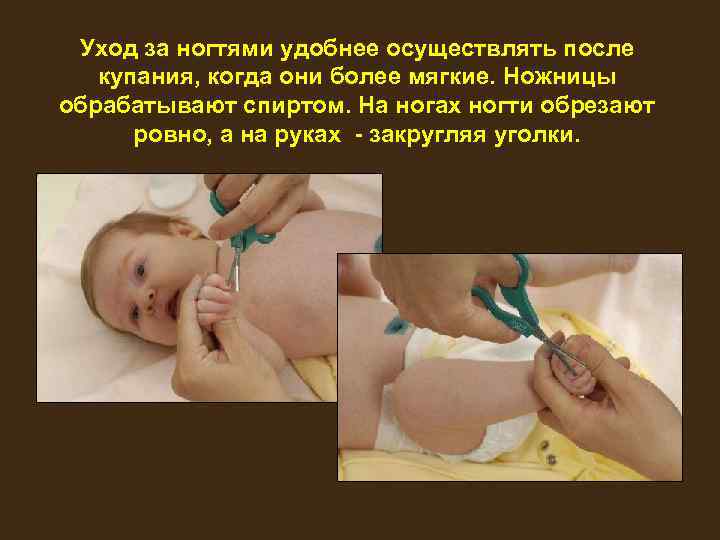 Уход за ногтями удобнее осуществлять после купания, когда они более мягкие. Ножницы обрабатывают спиртом.