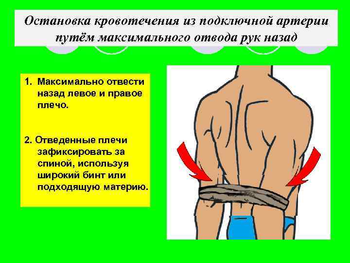 Остановка кровотечения из подключной артерии путём максимального отвода рук назад 1. Максимально отвести назад