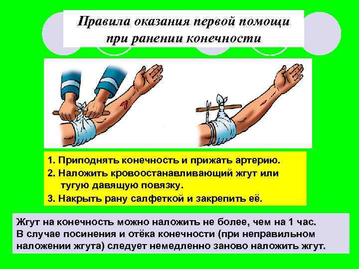 Правила оказания первой помощи при ранении конечности 1. Приподнять конечность и прижать артерию. 2.