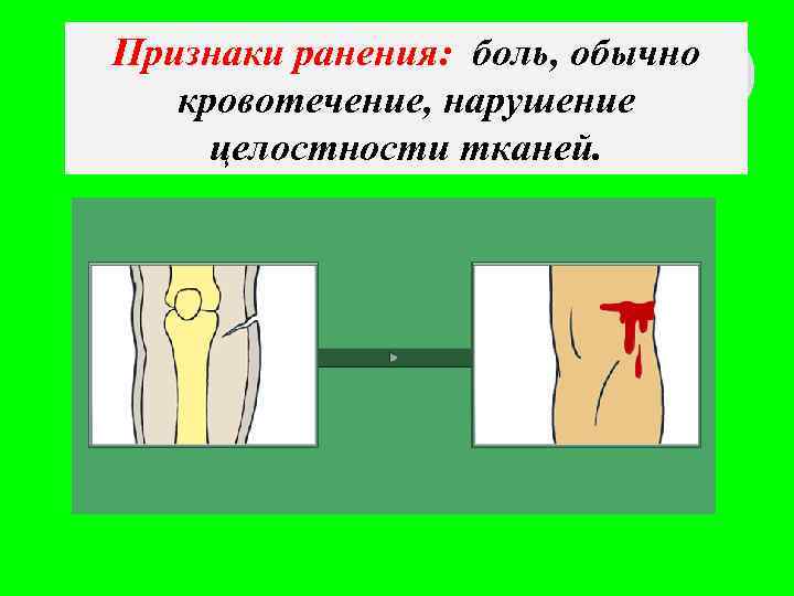 Признаки ранения: боль, обычно кровотечение, нарушение целостности тканей. 