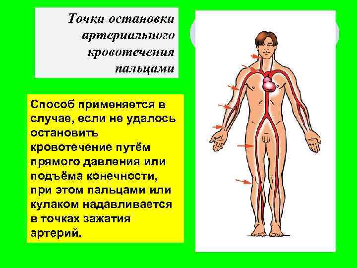 Точки остановки артериального кровотечения пальцами Способ применяется в случае, если не удалось остановить кровотечение