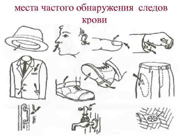 места частого обнаружения следов крови 