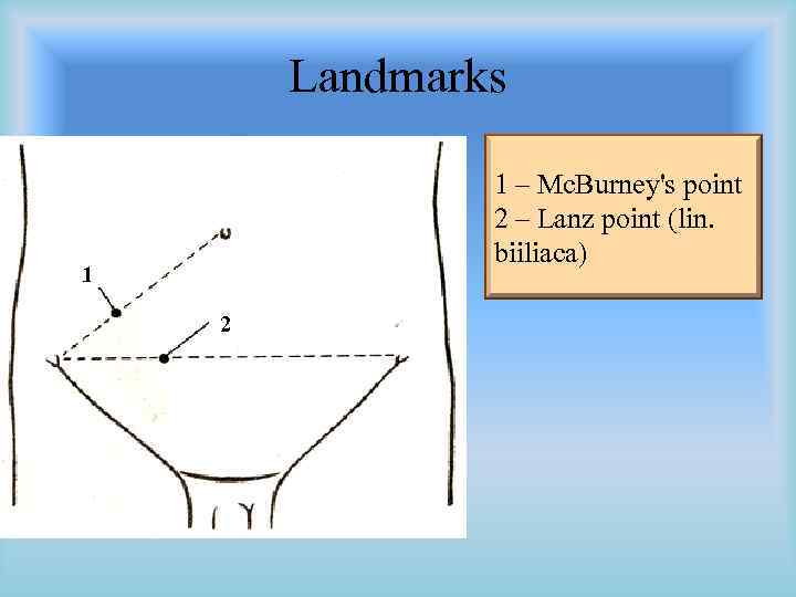 Landmarks 1 – Mc. Burney's point 2 – Lanz point (lin. biiliaca) 1 2