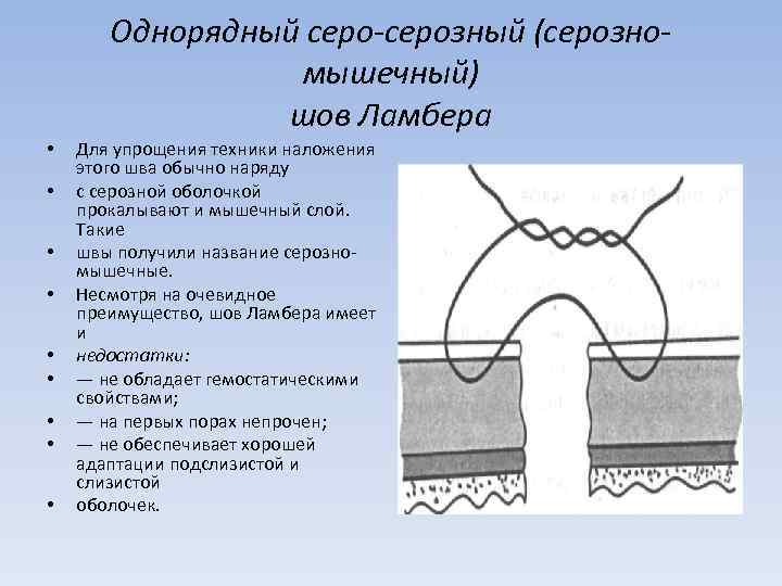 Однорядный серо-серозный (серозномышечный) шов Ламбера • • • Для упрощения техники наложения этого шва