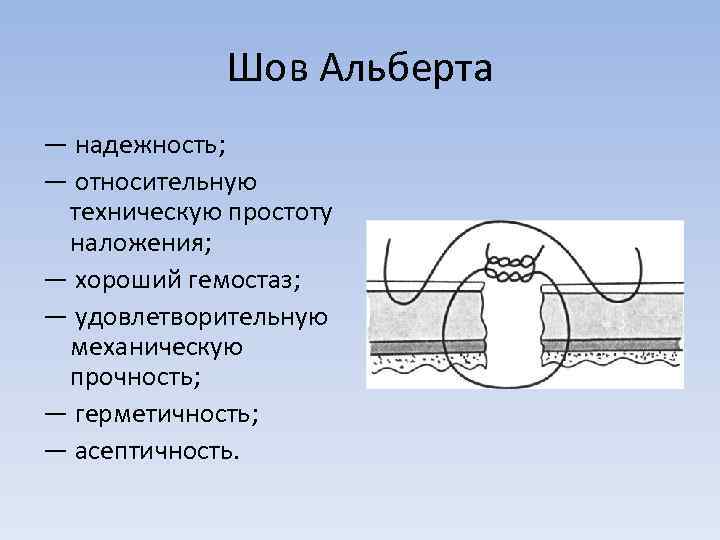 Шов Альберта — надежность; — относительную техническую простоту наложения; — хороший гемостаз; — удовлетворительную