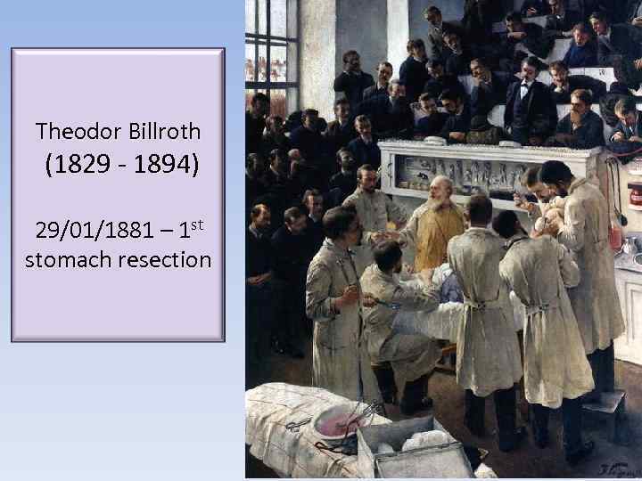 Theodor Billroth (1829 - 1894) 29/01/1881 – 1 st stomach resection 