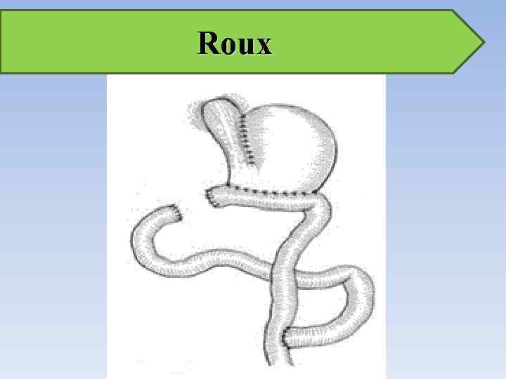 Roux 