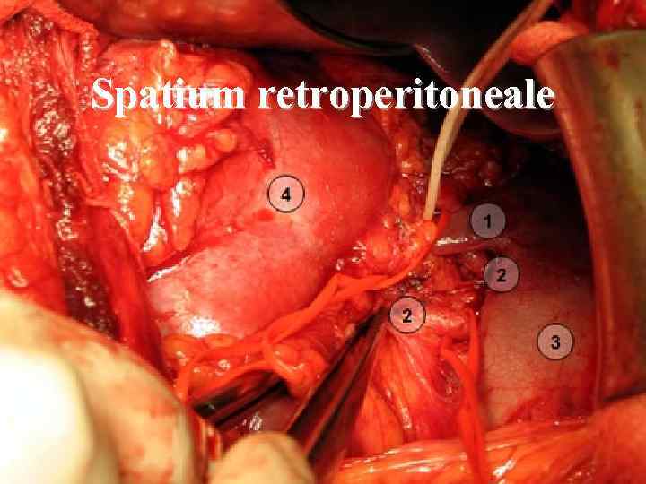 Spatium retroperitoneale 