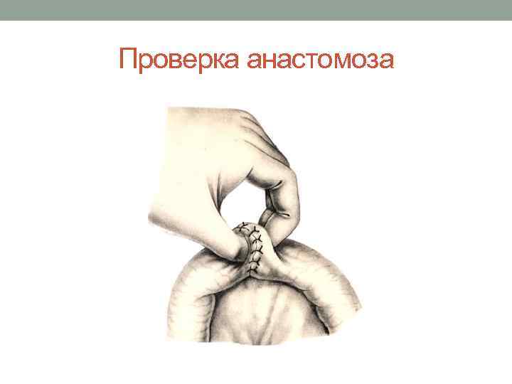 Проверка анастомоза 