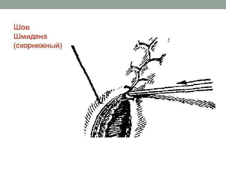 Шов Шмидена (скорняжный) 