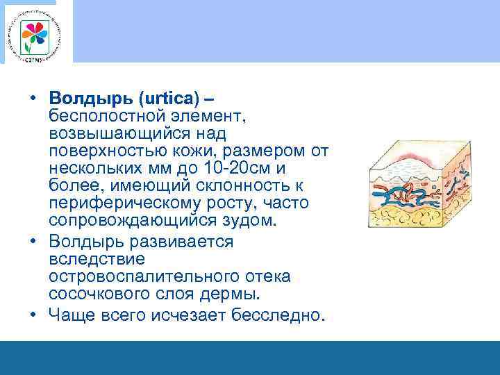  • Волдырь (urtica) – бесполостной элемент, возвышающийся над поверхностью кожи, размером от нескольких