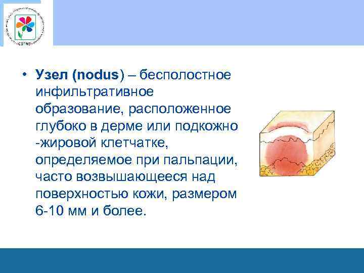 • Узел (nodus) – бесполостное инфильтративное образование, расположенное глубоко в дерме или подкожно