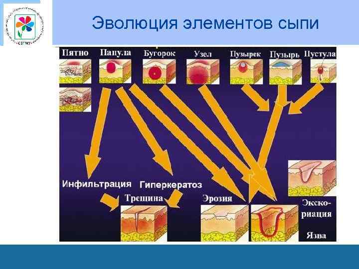 Эволюция элементов сыпи 