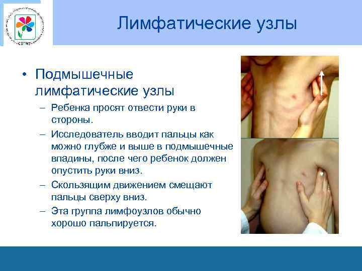 Лимфатические узлы • Подмышечные лимфатические узлы – Ребенка просят отвести руки в стороны. –