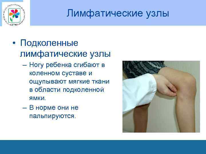 Лимфатические узлы • Подколенные лимфатические узлы – Ногу ребенка сгибают в коленном суставе и