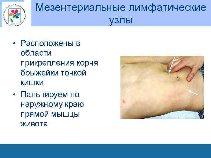 Мезентериальные лимфатические узлы • Расположены в области прикрепления корня брыжейки тонкой кишки • Пальпируем