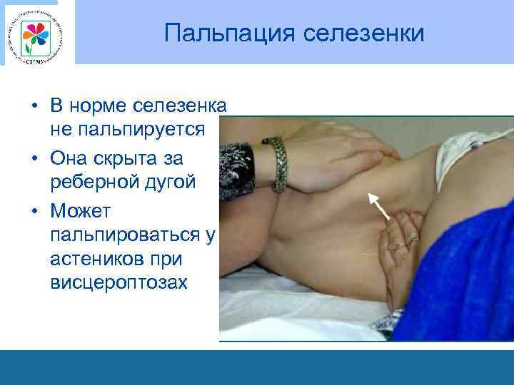 Пальпация селезенки • В норме селезенка не пальпируется • Она скрыта за реберной дугой